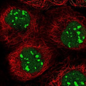 Anti-C1D antibody produced in rabbit 
