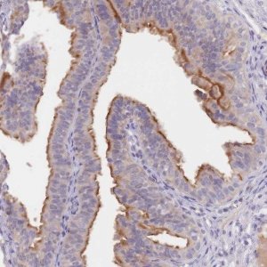 Anti-C1ORF189 antibody produced in rabbit 