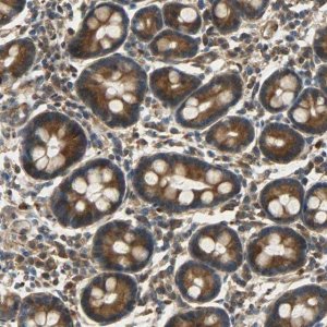 Anti-C1orf198 antibody produced in rabbit 
