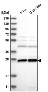 Anti-C1orf216 antibody produced in rabbit 