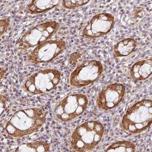 Anti-C1orf226 antibody produced in rabbit 