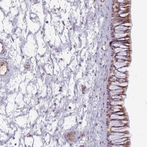 Anti-C1QTNF5 antibody produced in rabbit 