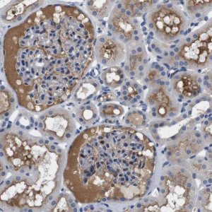 Anti-C1RL antibody produced in rabbit HPA011338-100UL