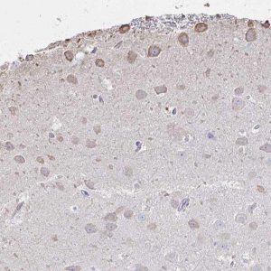 Anti-C20orf24 antibody produced in rabbit 