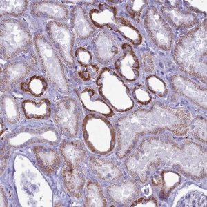 Anti-C21orf140 antibody produced in rabbit 