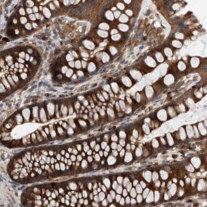 Anti-C21orf2 antibody produced in rabbit 