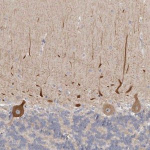 Anti-C21orf59 antibody produced in rabbit 
