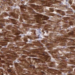 Anti-C22orf29 antibody produced in rabbit 