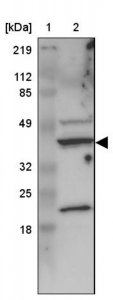 Anti-C22orf29 antibody produced in rabbit 