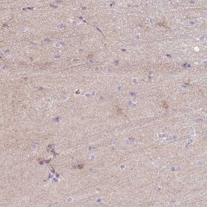Anti-C2CD4C antibody produced in rabbit 