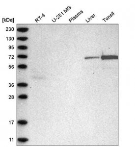 Anti-C2orf42 antibody produced in rabbit HPA031840-100UL