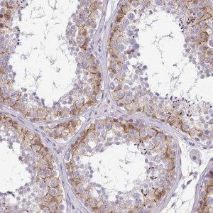 Anti-C2orf61 antibody produced in rabbit 