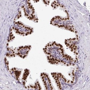 Anti-C2orf71 antibody produced in rabbit 