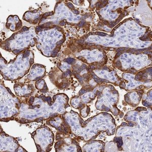 Anti-C2orf72 antibody produced in rabbit 