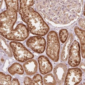 Anti-C2orf73 antibody produced in rabbit 