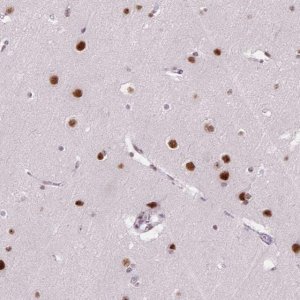 Anti-C2orf82 antibody produced in rabbit 