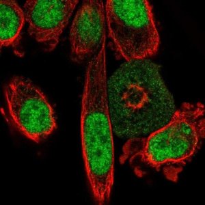 Anti-C2orf82 antibody produced in rabbit 