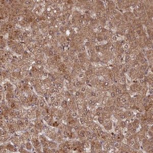 Anti-C2orf91 antibody produced in rabbit 