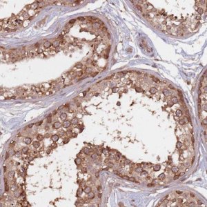 Anti-C3ORF14 antibody produced in rabbit 