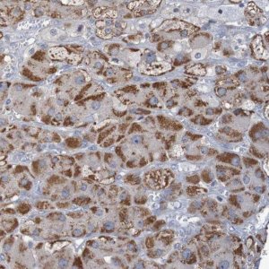 Anti-C3orf18 antibody produced in rabbit 