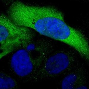 Anti-C3orf18 antibody produced in rabbit 