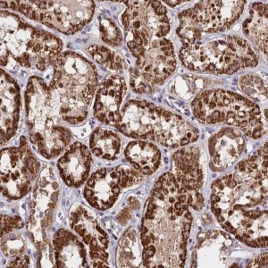Anti-C3orf20 antibody produced in rabbit 