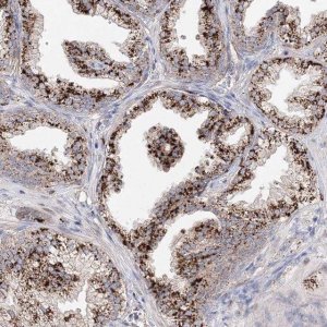 Anti-C3orf38 antibody produced in rabbit 