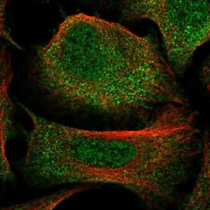 Anti-C3orf38 antibody produced in rabbit 