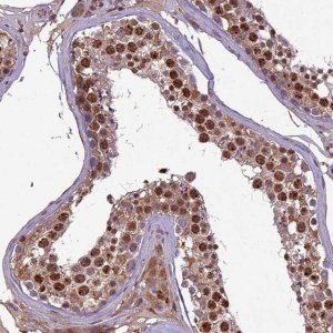 Anti-C3orf70 antibody produced in rabbit 