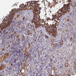 Anti-C4BPB antibody produced in rabbit 