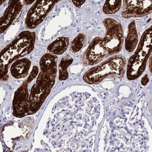Anti-C4ORF46 antibody produced in rabbit 
