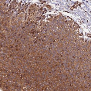 Anti-C5orf22 antibody produced in rabbit 