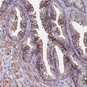 Anti-C6 antibody produced in rabbit 