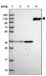 Anti-C6 antibody produced in rabbit 