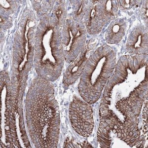 Anti-C6orf1 antibody produced in rabbit 