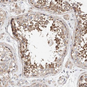 Anti-C6orf118 antibody produced in rabbit 