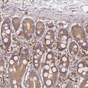 Anti-C6ORF136 antibody produced in rabbit 