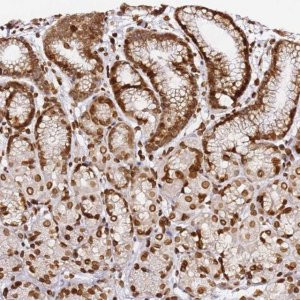 Anti-C6orf141 antibody produced in rabbit 