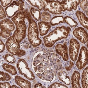Anti-C6ORF203 antibody produced in rabbit 