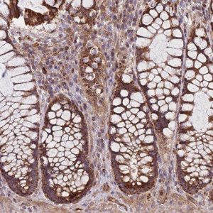 Anti-C6ORF203 antibody produced in rabbit 