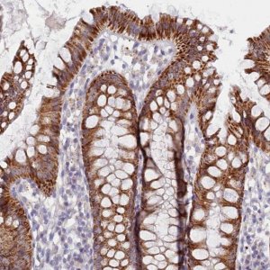 Anti-C6orf223 antibody produced in rabbit 
