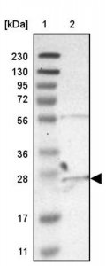 Anti-C6orf89 antibody produced in rabbit 