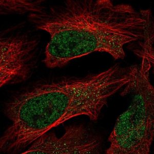 Anti-C7orf25 antibody produced in rabbit HPA049635-100UL