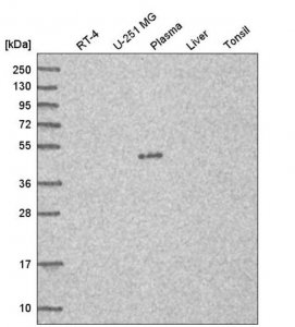 Anti-C7orf25 antibody produced in rabbit HPA049635-100UL