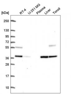 Anti-C9orf64 antibody produced in rabbit HPA066190-100UL