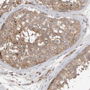 Anti-C9orf72 antibody produced in rabbit 