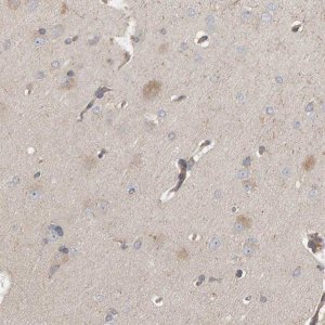 Anti-C9orf72 antibody produced in rabbit 