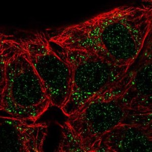 Anti-CA10 antibody produced in rabbit 