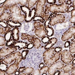 Anti-CA12 antibody produced in rabbit 