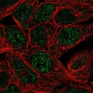Anti-CA12 antibody produced in rabbit 